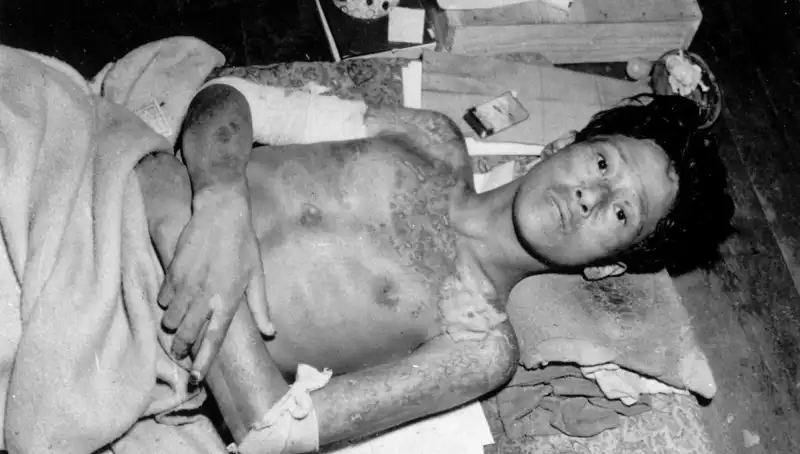 80 Yıl Sonra Nagasaki’den Gelen Sarsıcı Uyarı: Nükleer Felaket Kapıda mı?