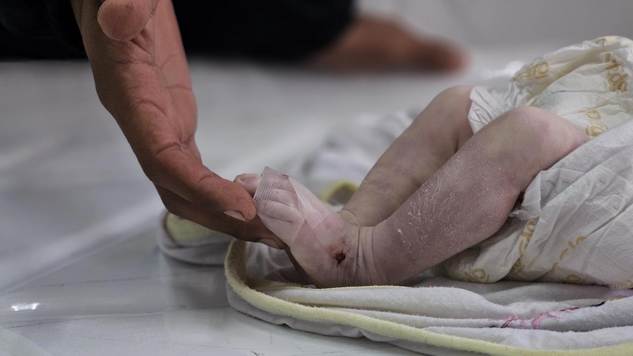 Gazze'de Donarak Ölen Bebek Sayısı 7'ye Yükseldi