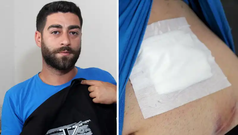 Karnındaki Ağrının Sebebi Röntgende Şaşırtan Gerçekle Ortaya Çıktı
