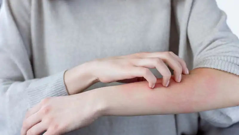 Cilt Kanserinin Gözden Kaçan İki Belirtisi: Dermatologdan Önemli Açıklamalar
