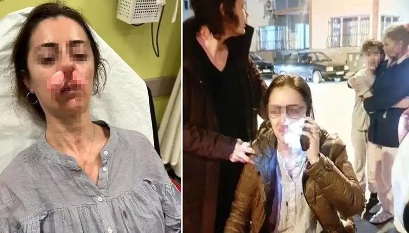 Eşinin Sevgilisi Sandığı Otomobil Kapısıyla Saldırdı, Korkunç Olay!