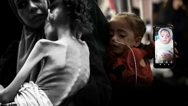 Küçük Meryem'in Açlıkla Savaşan Zorlu Hayatı: 25 Kilodan 10 Kiloya Düştü